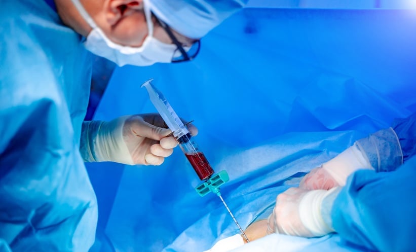 Shwachman-Diamond syndrome haematopoietic cell transplantation HCT AML MDS bone marrow failure haematology