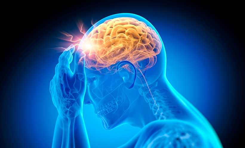 Brain Aneurysms May Be Twice as Common as Thought