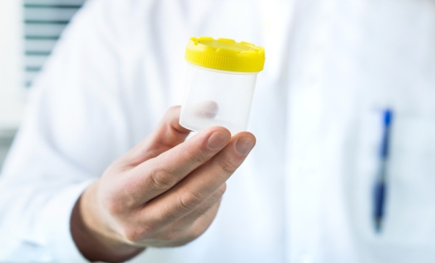 Doctor in white coat holding urine test