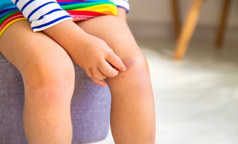EDDs and Growth Impairment in Children - EMJ