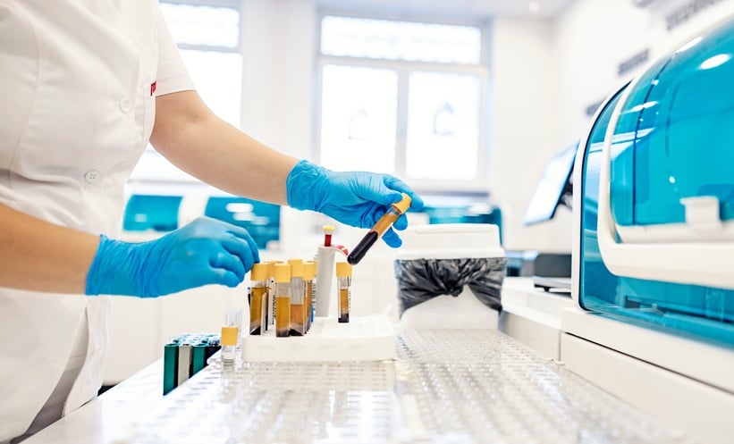 Plasma Protein Signatures in Ankylosing Spondylitis - EMJ