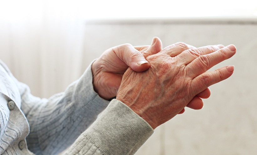 10 Years After Treat-to-Target Therapy for Early RA - EMJ