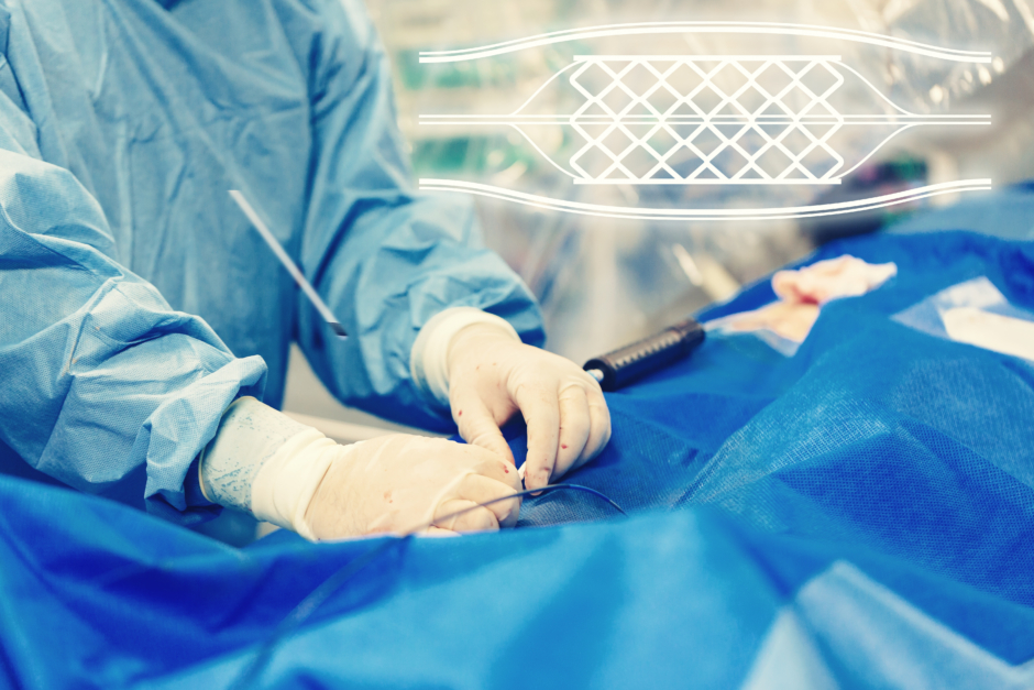 MRI-guided stenting