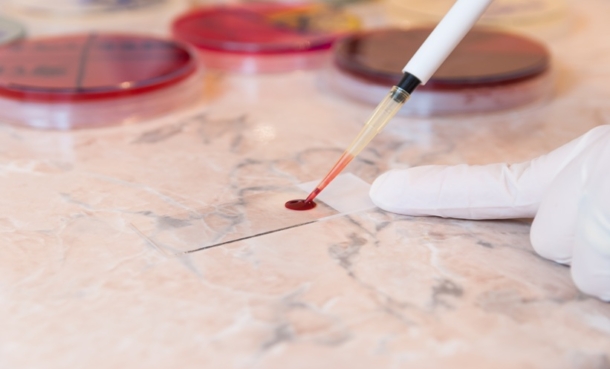 hydroxyurea infection risk