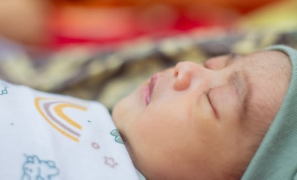 baby with sanflippo syndrome