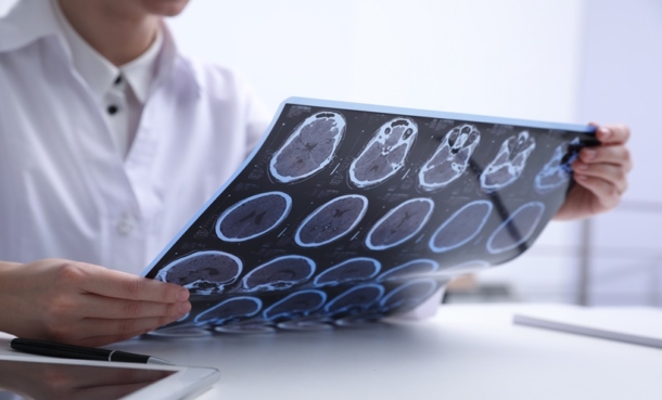 Doctor examining MRI images of patient with multiple sclerosis at table in clinic, closeup