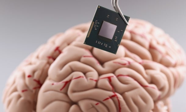 brain chip