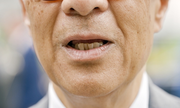 Close-up of an adult patient’s mouth showing visible teeth, illustrating oral health in COPD care.