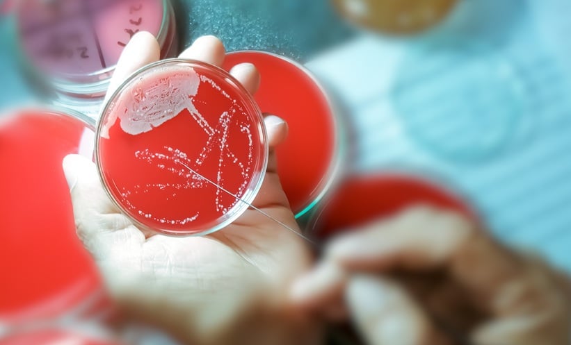 Laboratory technician examining bacterial cultures in a petri dish, illustrating research into antimicrobial resistance.