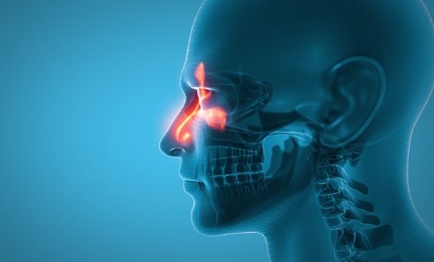 an image of a nasal x-ray