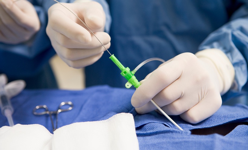 Lithotripsy for Calcified Left Main Coronary Stenting