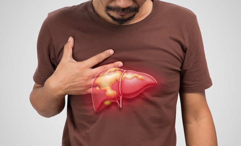 NAFLD, Type 2 diabetes, machine learning, XGBoost, diabetes risk prediction, metabolic health