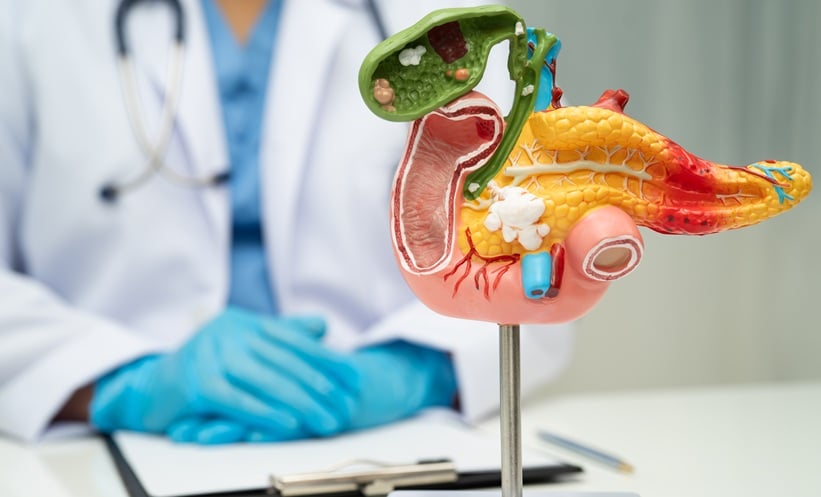 Liver, pacreas and biliary tract model showing where cancer would develop