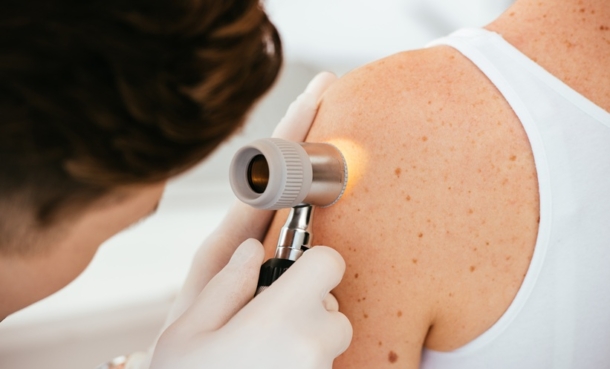 Doctor inspecting the skin of person for melenoma