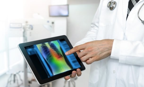 doctor pointing to a CT lung scan