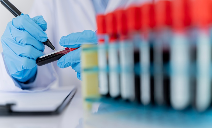 Doctor labels a blood sample