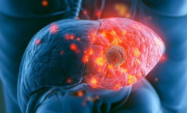 picture of a liver