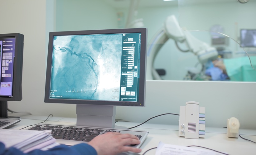 Coronary angiography