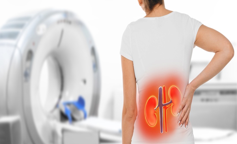 Automated Segmentation for Fast TKV Quantification -EMJ