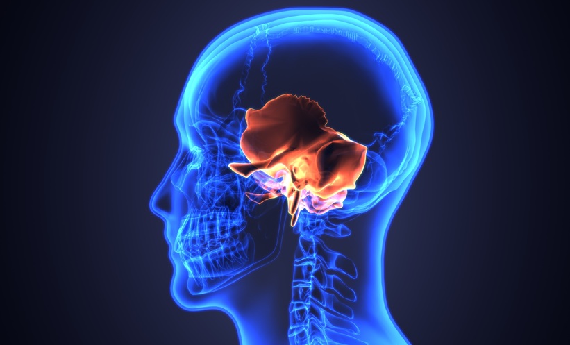 3d image of skull temporal bone
