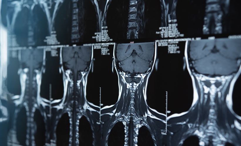 CT scans of a neck