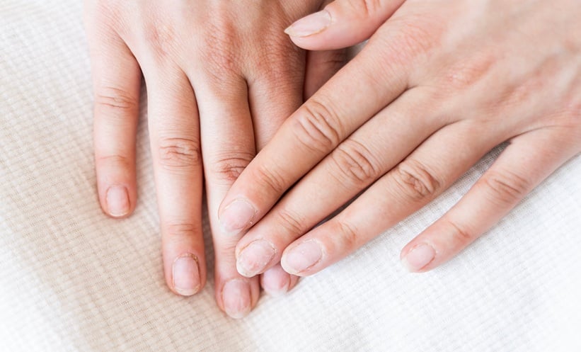 GLP-1 Nail Disorders More Common in Users - EMJ